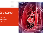 Verem (Tüberküloz) Bilgiyle Önlenir!