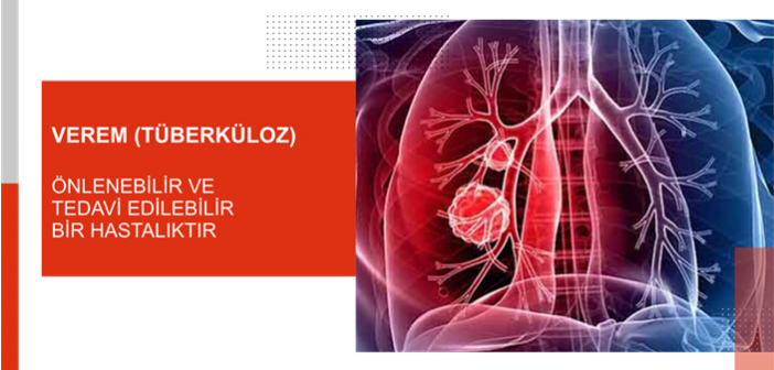 Verem (Tüberküloz) Bilgiyle Önlenir!